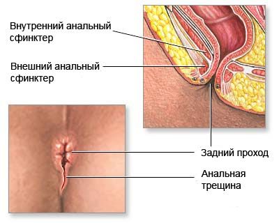 afføring under analsex