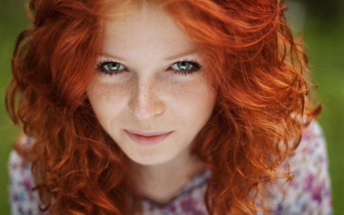 Fra hudkræft redheads vil ikke spare selv afslag på solskoldning