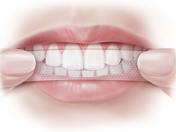 Hvordan man bruger hvidestrimler til tænder?