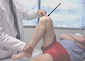 Smerter i knæet under bøjning er den mest almindelige årsag til, at folk besøger traume læger. 